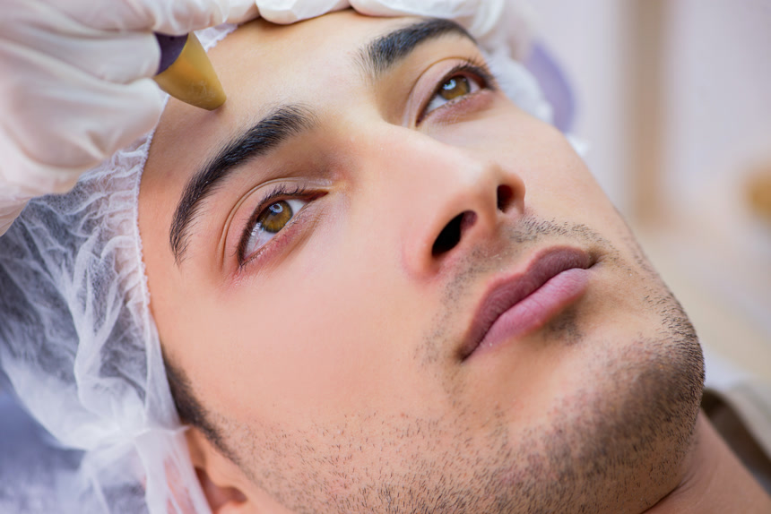 男子在皮肤科进行激光疤痕祛除   医疗美容  医院宣传  