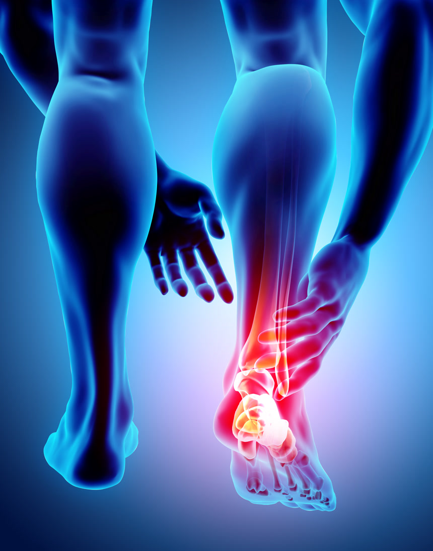 踝关节痛苦-骨骼 x 射线医疗保健