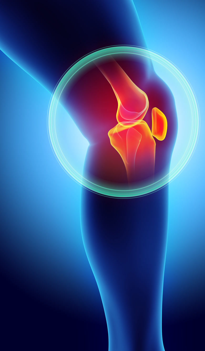 膝关节疼痛骨骼射线三维图医疗影像医疗人像