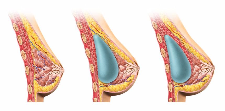 女人乳房内部解剖学医院宣传