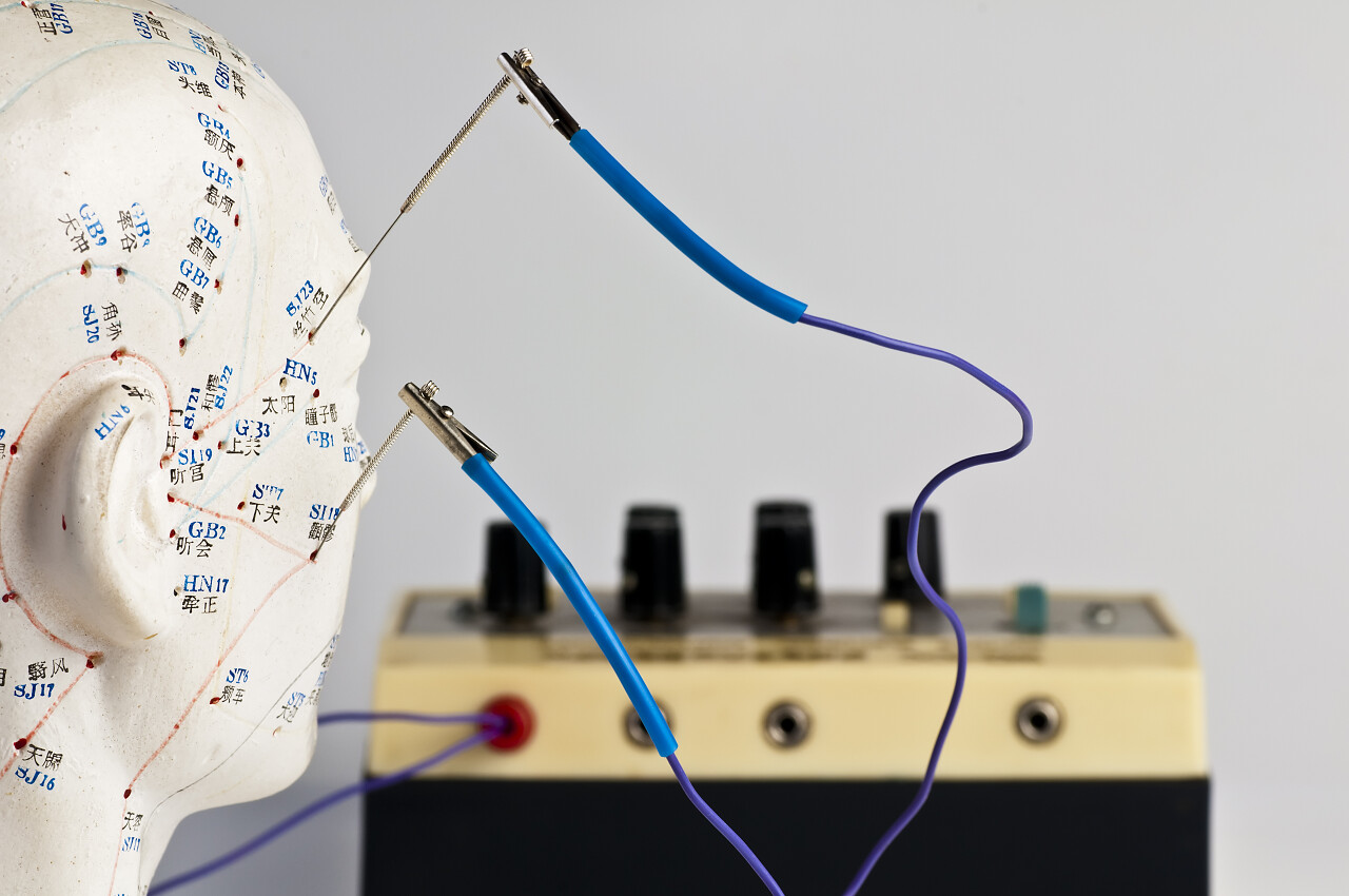 医学治疗设备插入人体模型头部的电针
