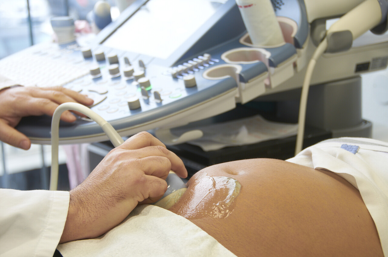 医院怀孕孕妇做超声波肚皮特写