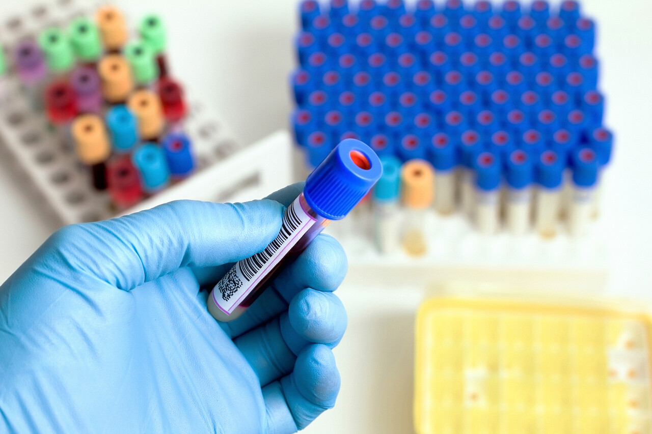 血液管底部试管