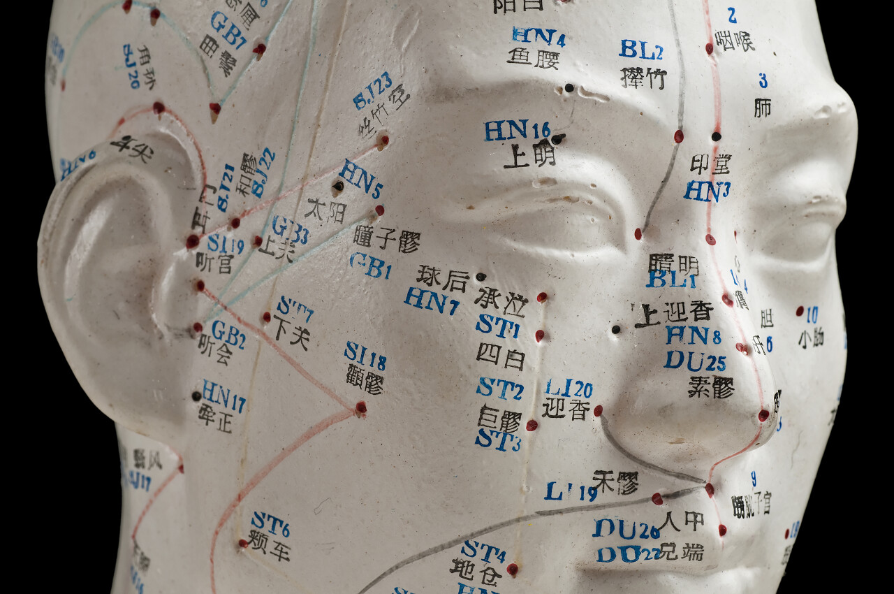 针刺头部模型针灸医疗图片