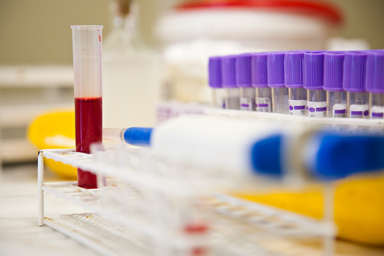 在实验室中的血液样本