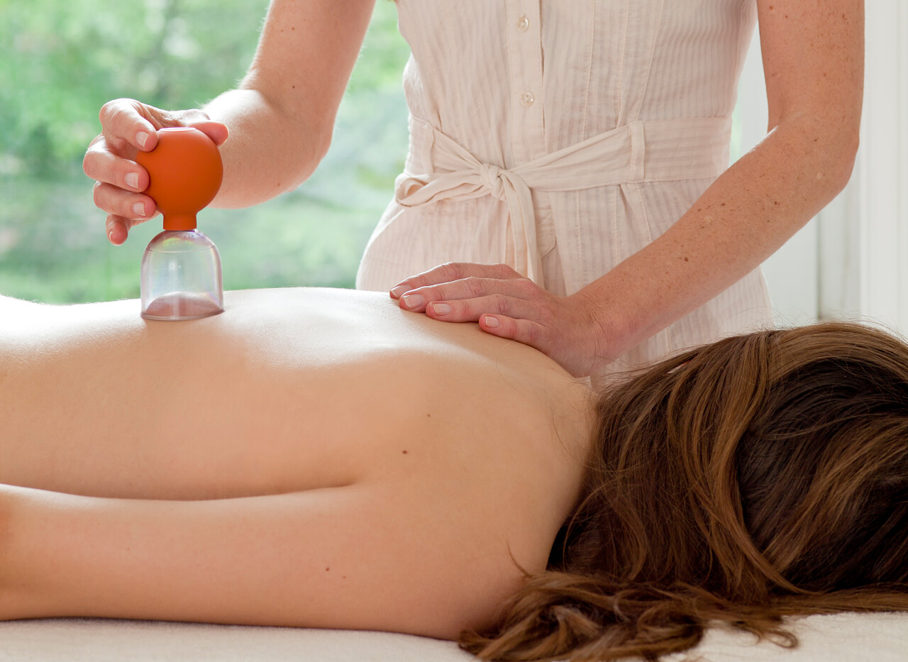 在做拔罐的女人中医养生拔罐