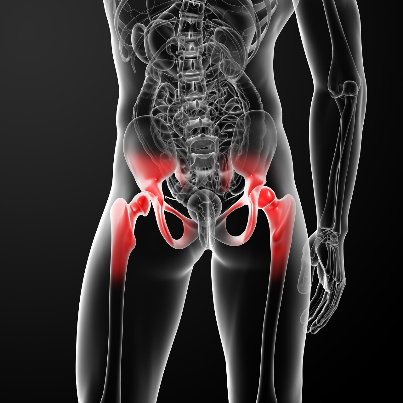 人体髋关节透视图