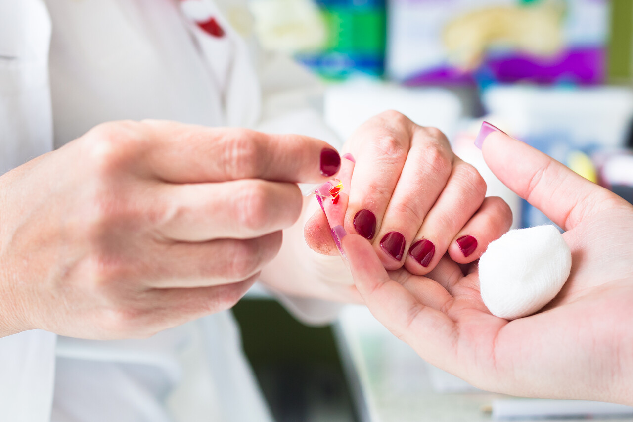 医生采用血型检测试剂盒与抗血型测定进行快速点刺试验和 b 抗体在一张白色卡片上