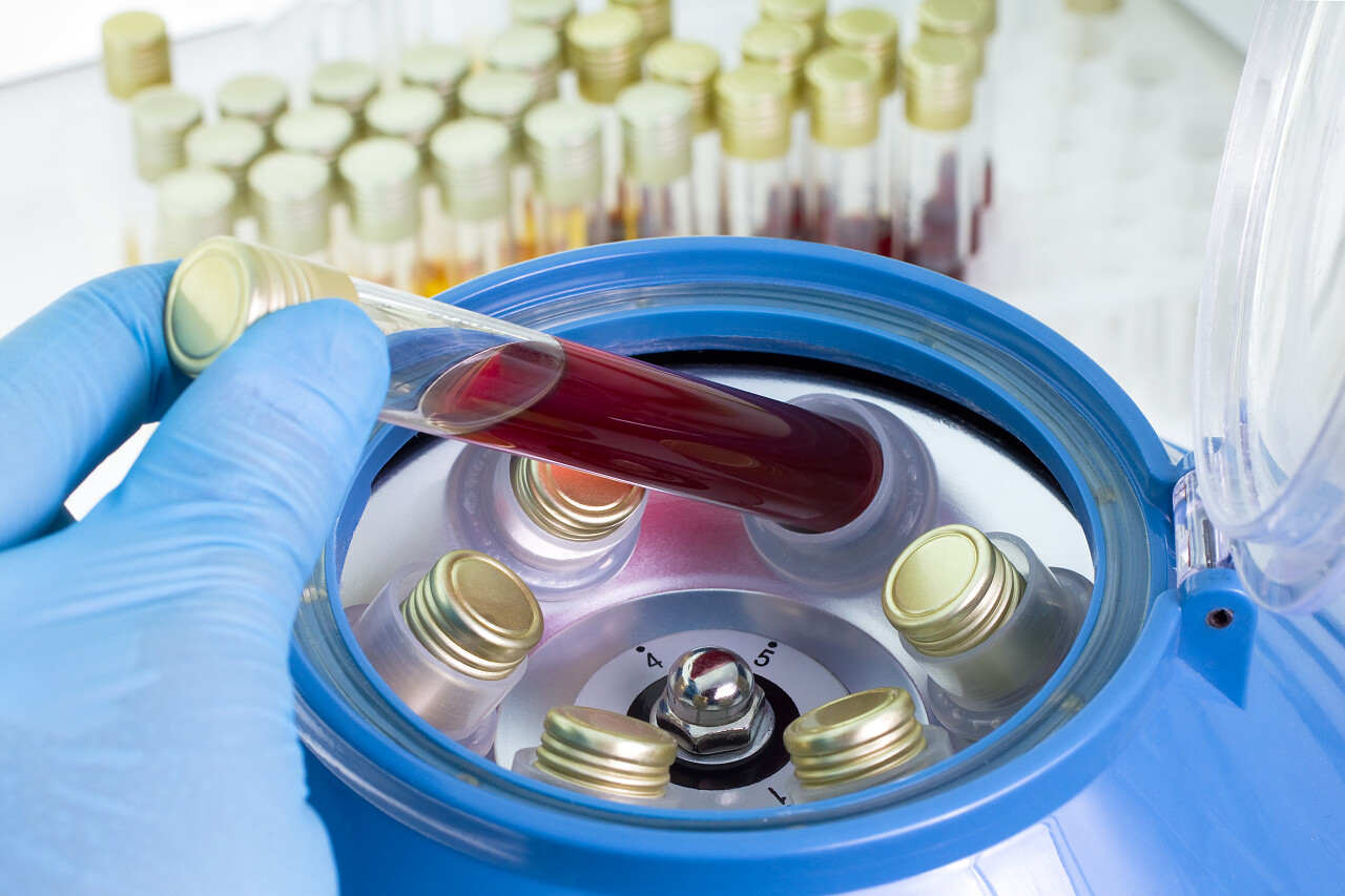 一管血进入离心机实验室一名医生的手