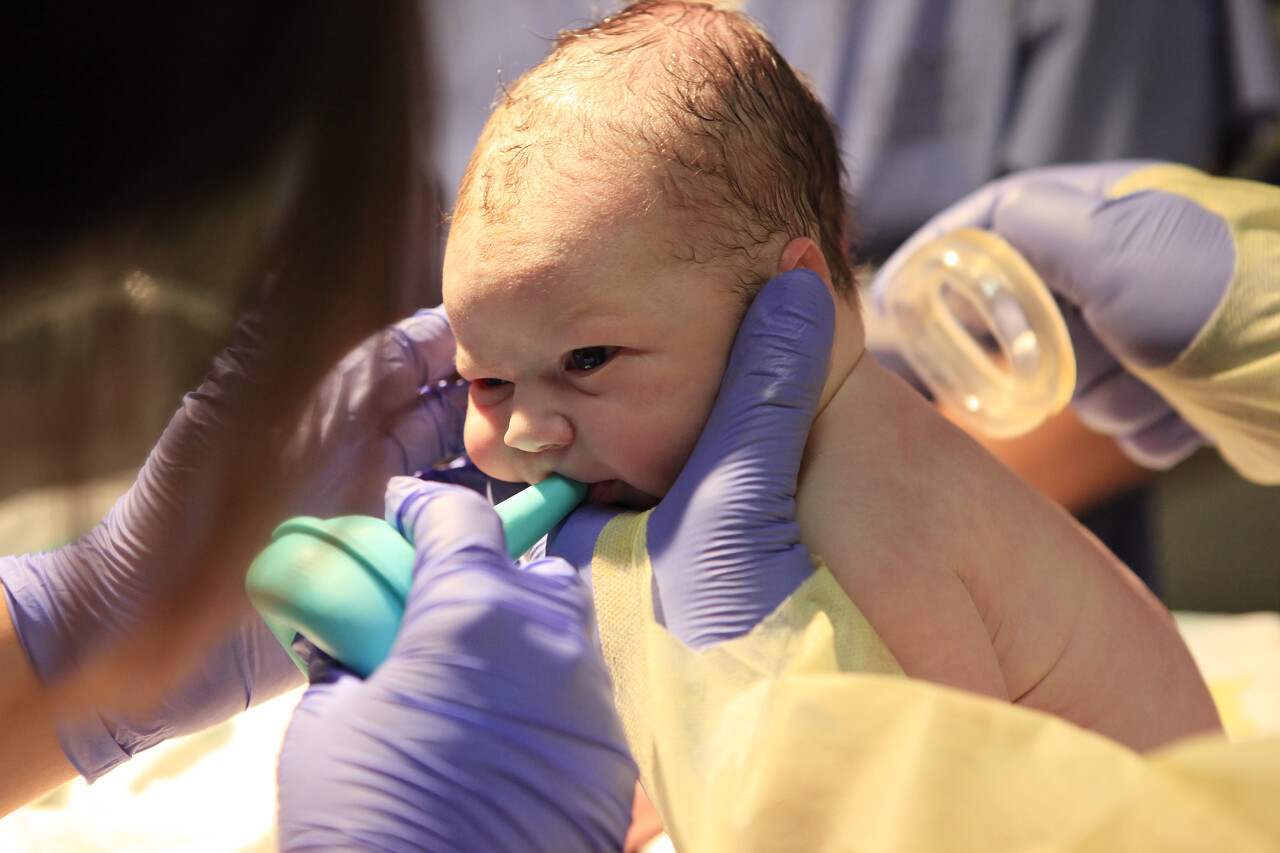 第一分钟的生命刚出生的女婴