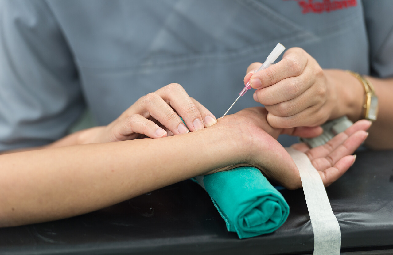 打开桡动脉动脉线监视器医生打针注射