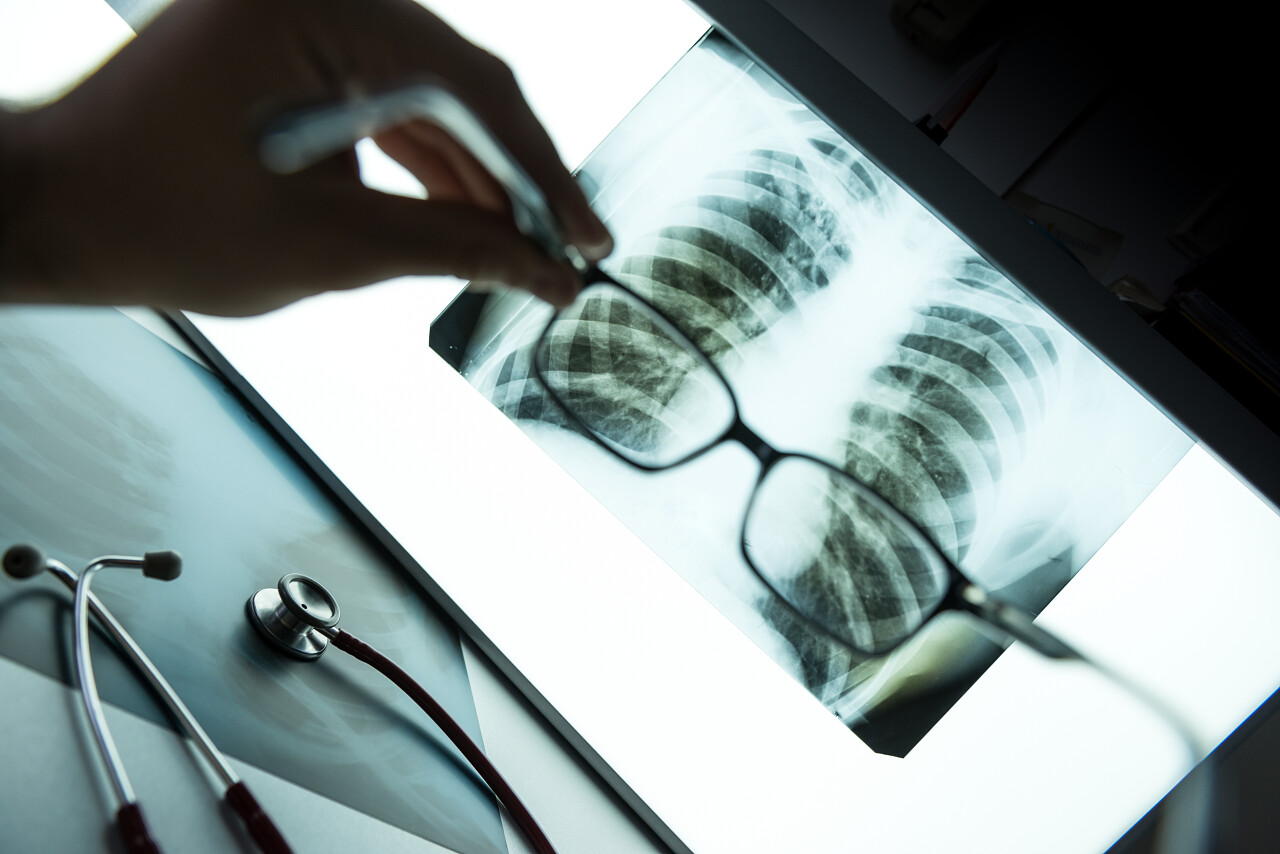 医生在办公室用眼镜检查X射线图像
