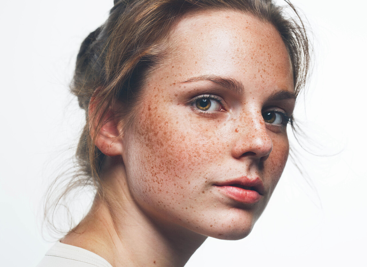 在明亮的背景上的雀斑女人特写
