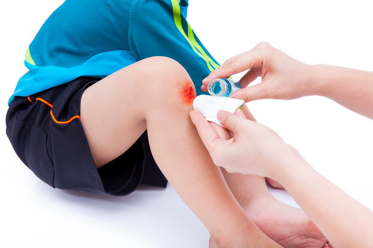 母亲正在清洁儿子腿上的伤口