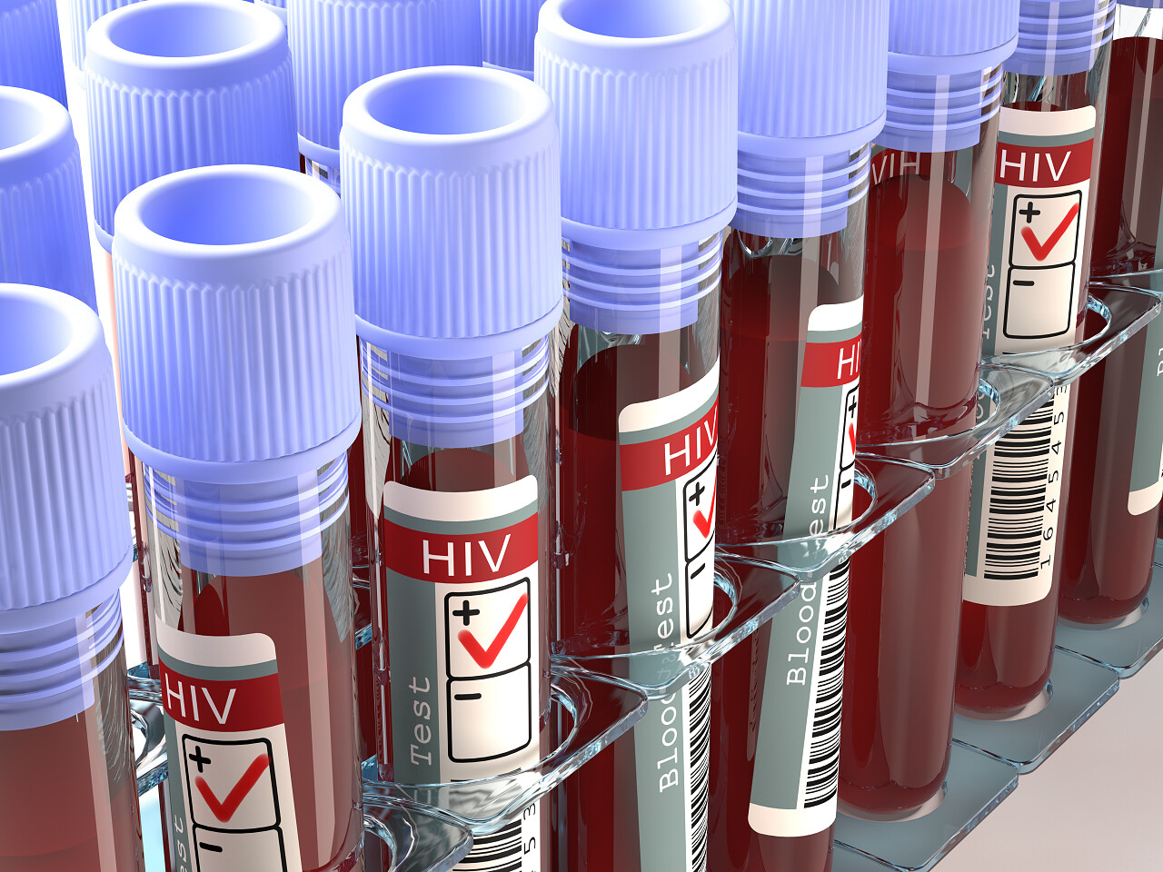 医疗灰色背景上艾滋病毒测试的结果