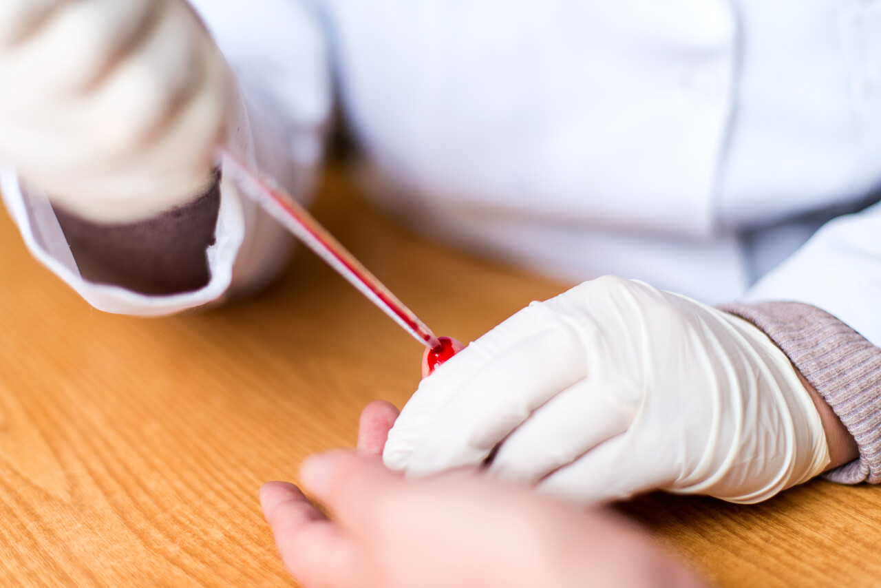 抽血化验检查个项指标指标提升