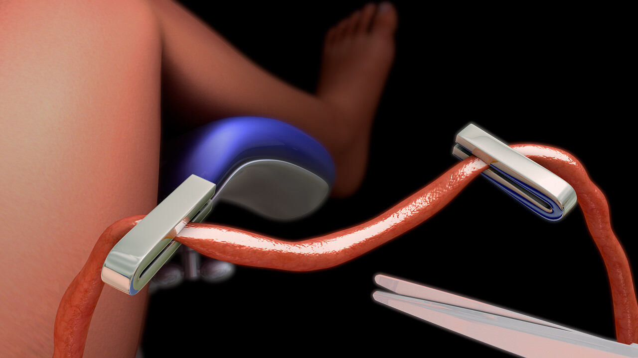 脐带新生儿脐带脐带切割人体器官透视图身体内部血管器官