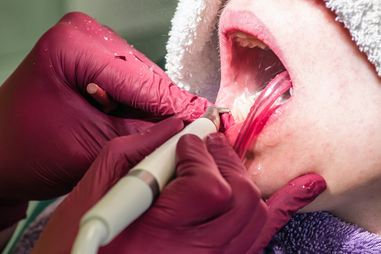 手拿喷砂机的牙医口腔卫生