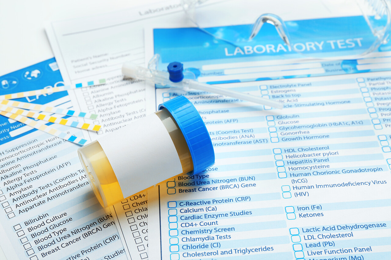 实验室分析测试窗体上的项目