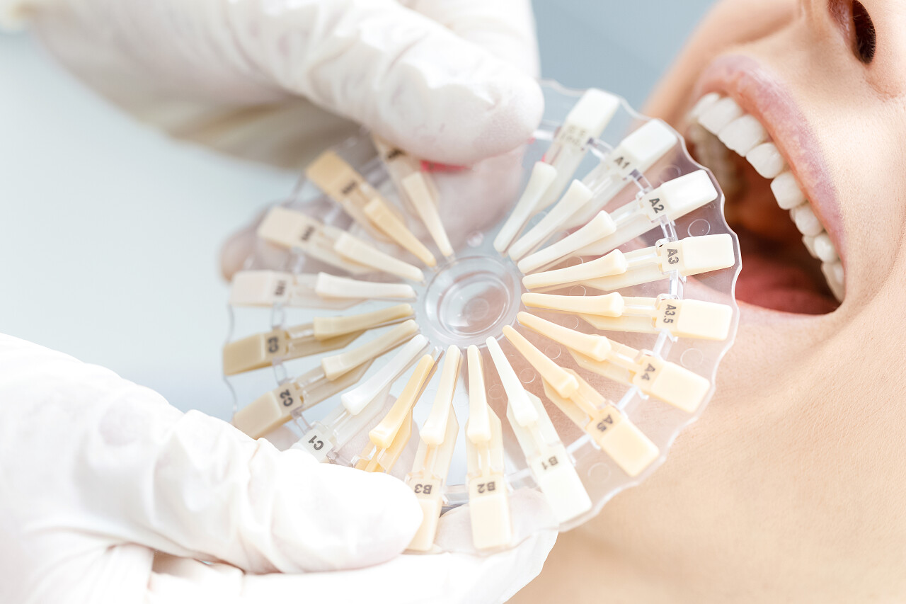 牙医比较牙齿的患者样本的特写局部视图牙科口腔口腔牙齿