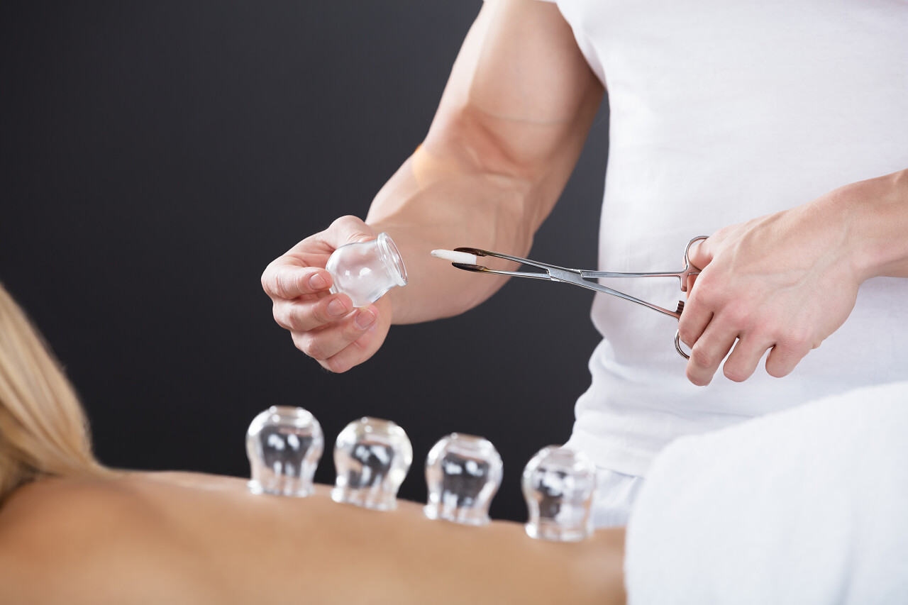 该名女子躺在前台接受拔罐治疗背上中医养生拔罐