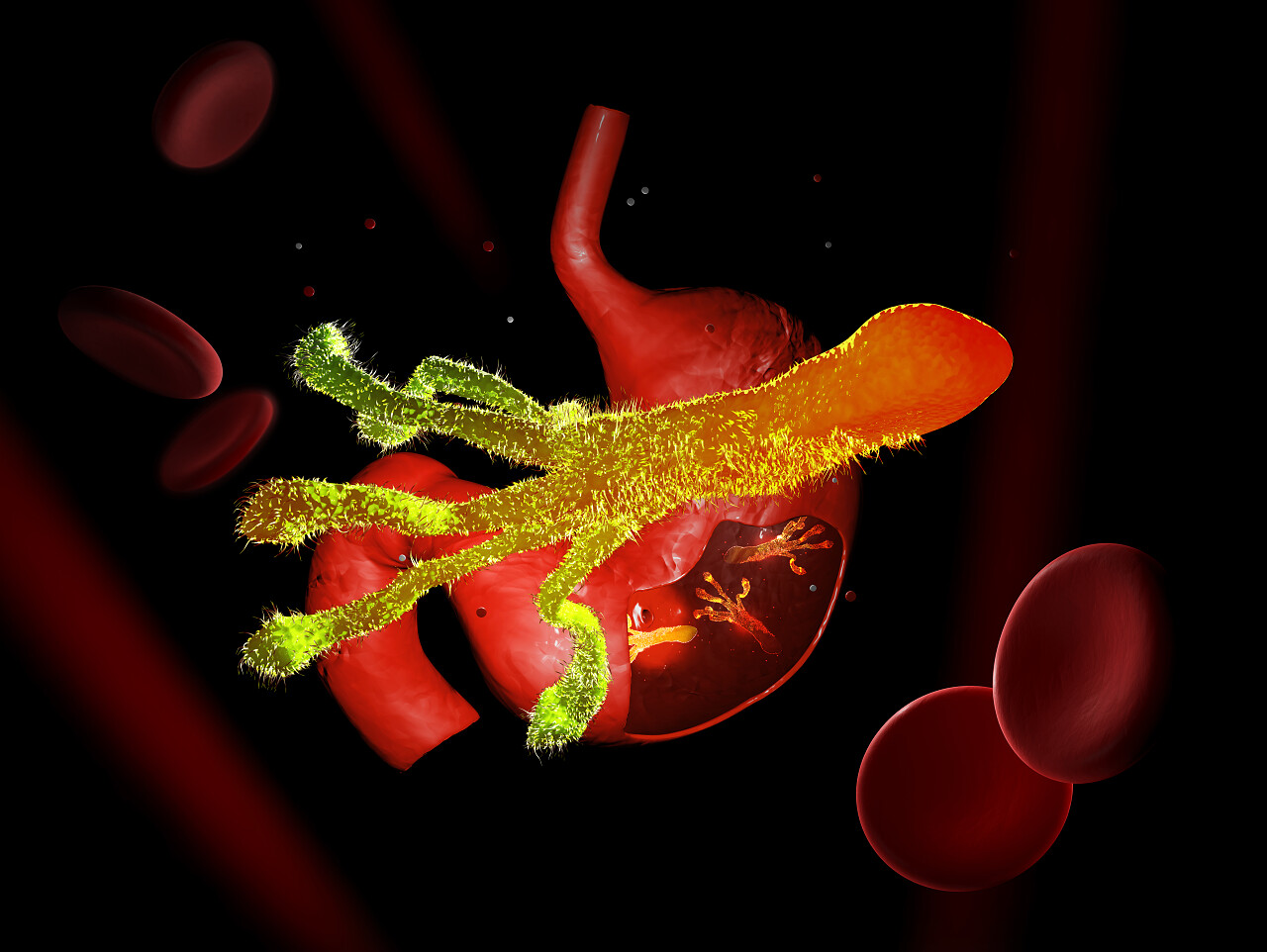 幽门螺杆菌接种细菌发现在胃里