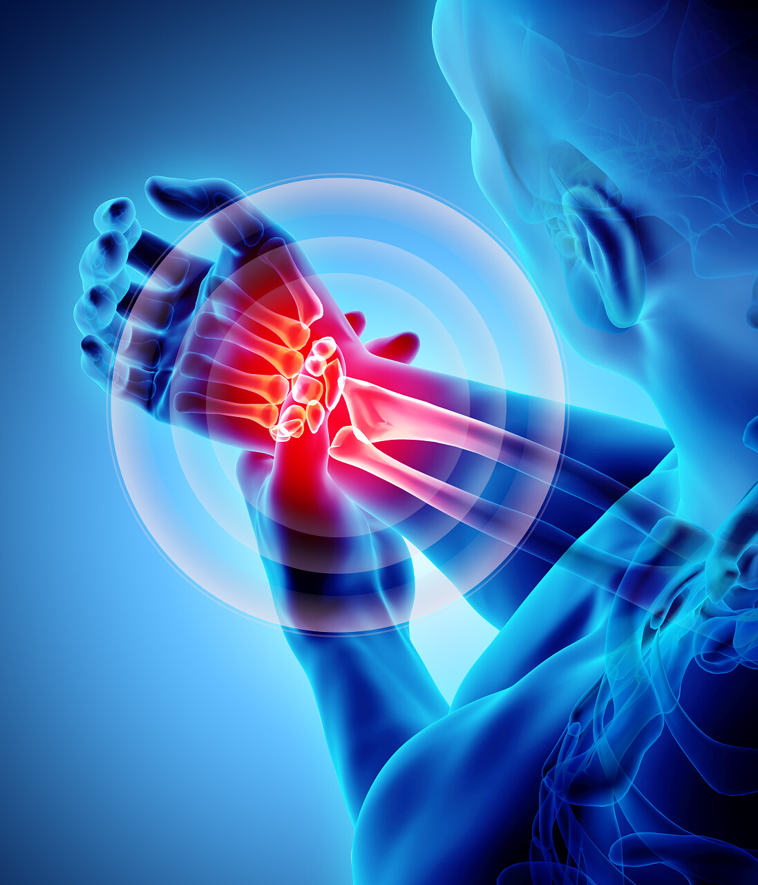 腕关节痛苦骨骼 x 射线