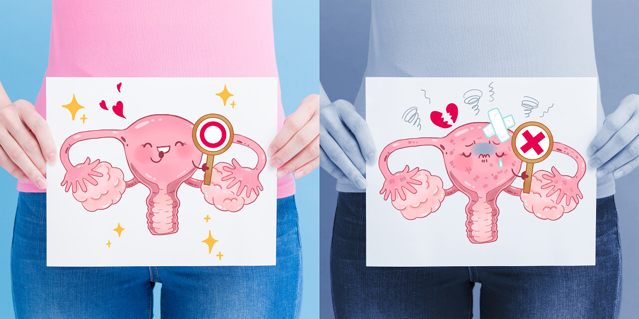 健康和不健康的子宫广告牌