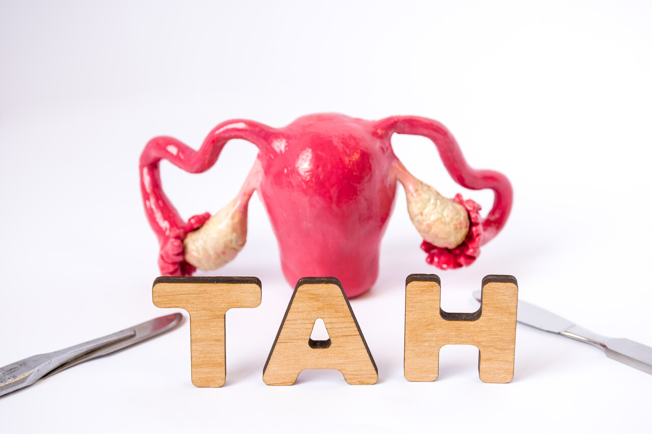 子宫与卵巢的解剖形状