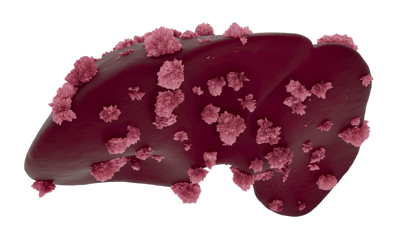 医学上细胞癌症肿瘤防治