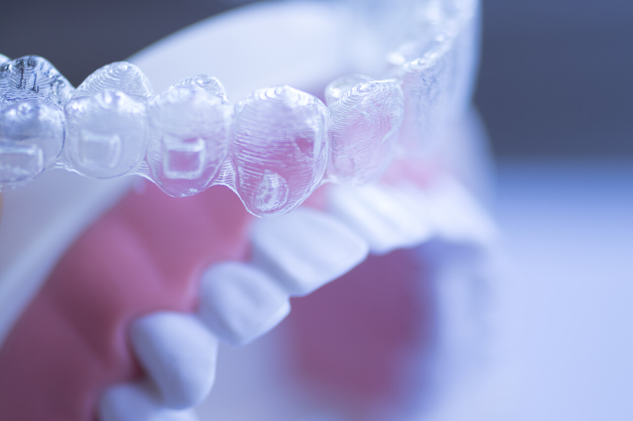 牙齿牙套特写牙齿矫正修复口腔牙齿口腔牙齿