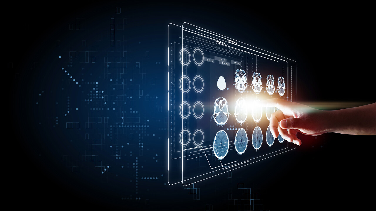 医疗技术Ct大脑和X射线图像