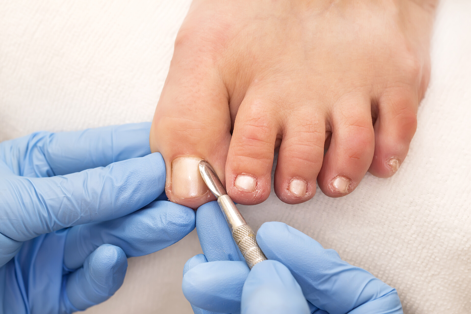 在院的修脚的过程