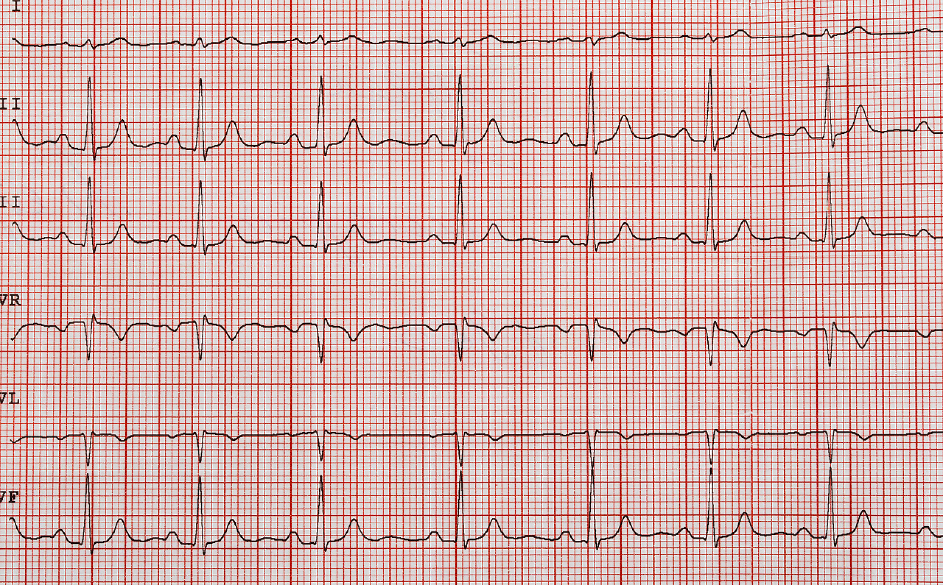 心电图数据线磁带的男人心电图
