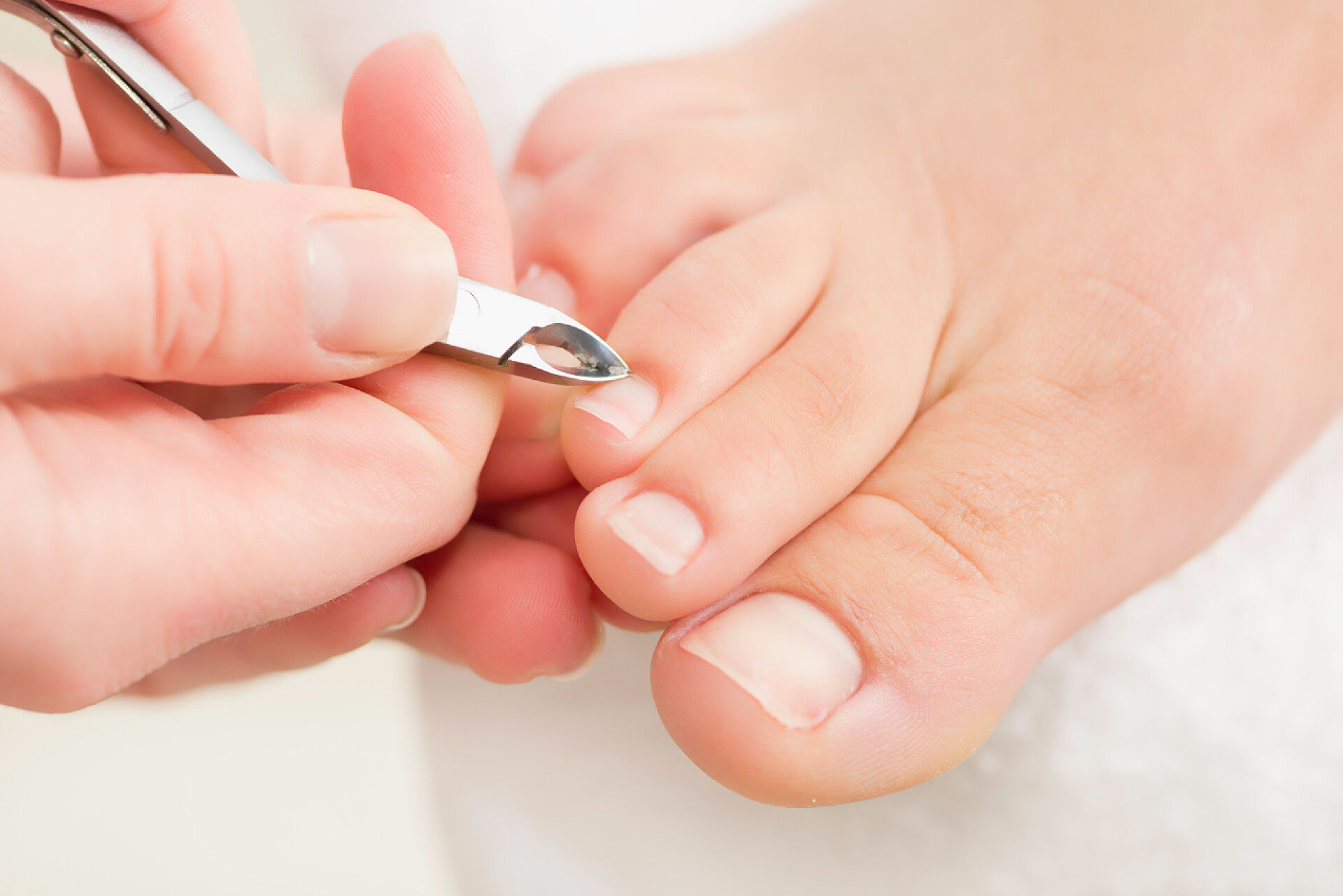 修脚过程特写咬指甲的修脚过程