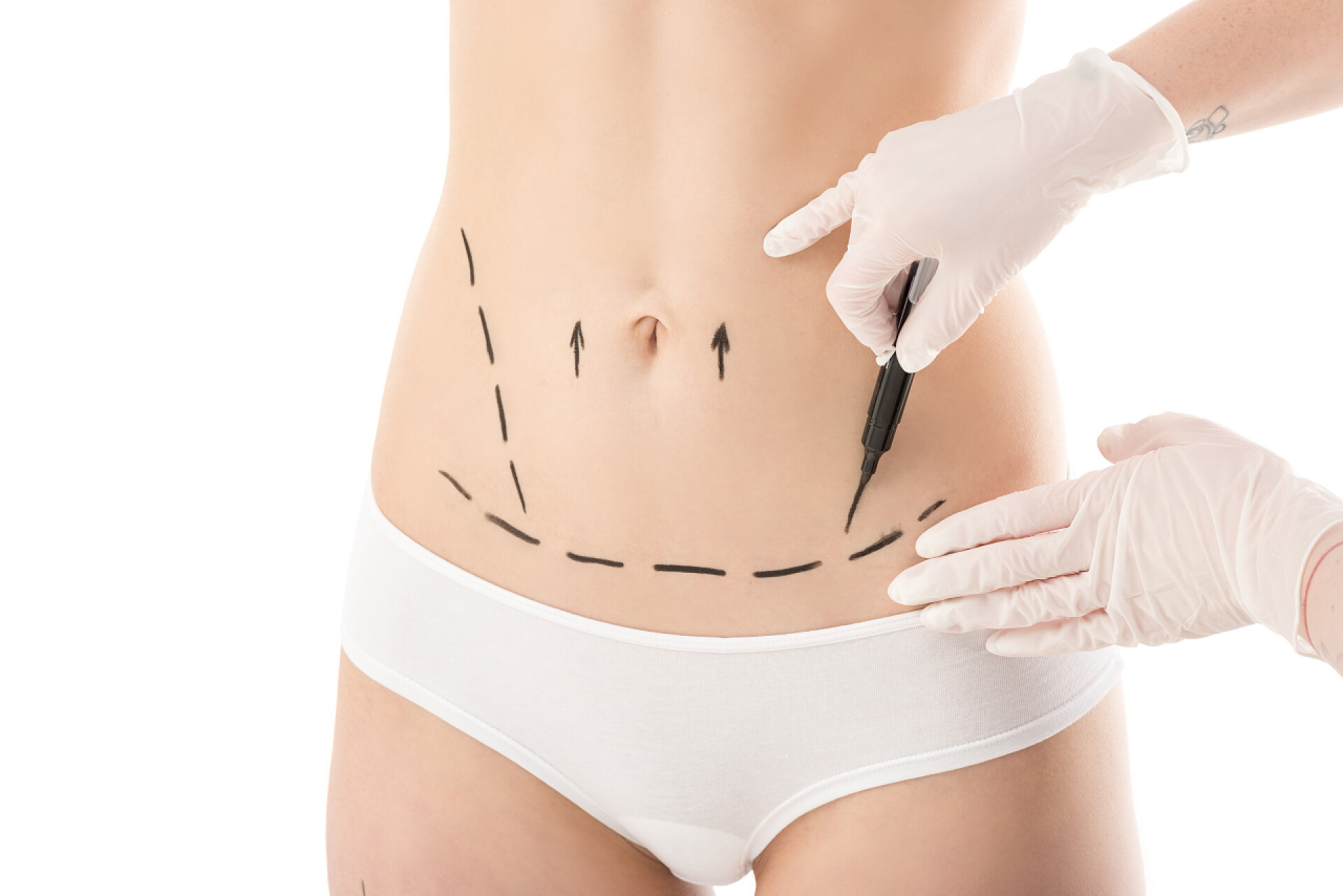 整形外科医生在设计身体的结构乳胶手套中整形外科医生的部分视图，使身体上的痕迹被隔离在白色上