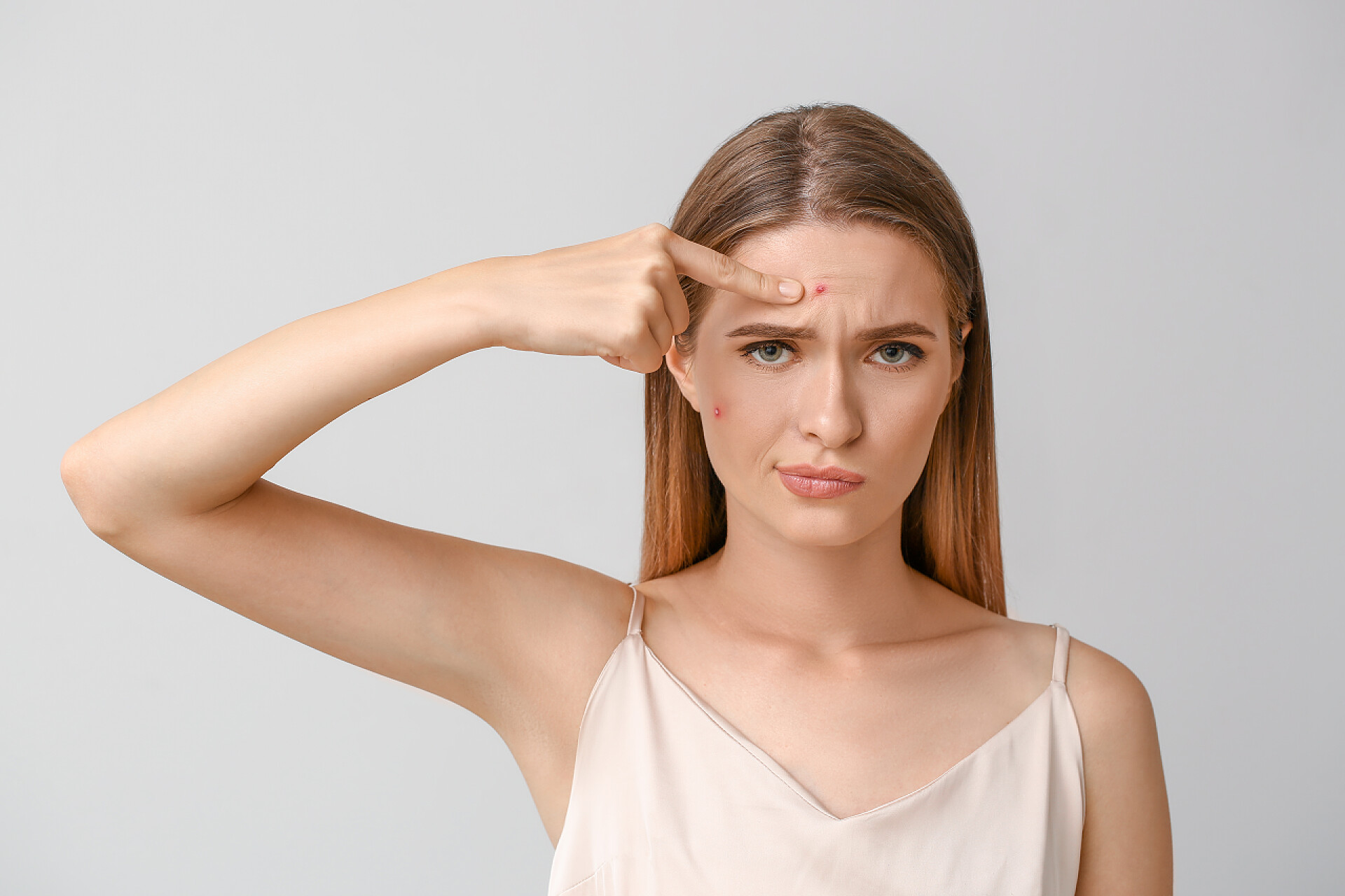 灰色背景上女孩处理脸上的痤疮浅背景下有痤疮问题的年轻女子的肖像