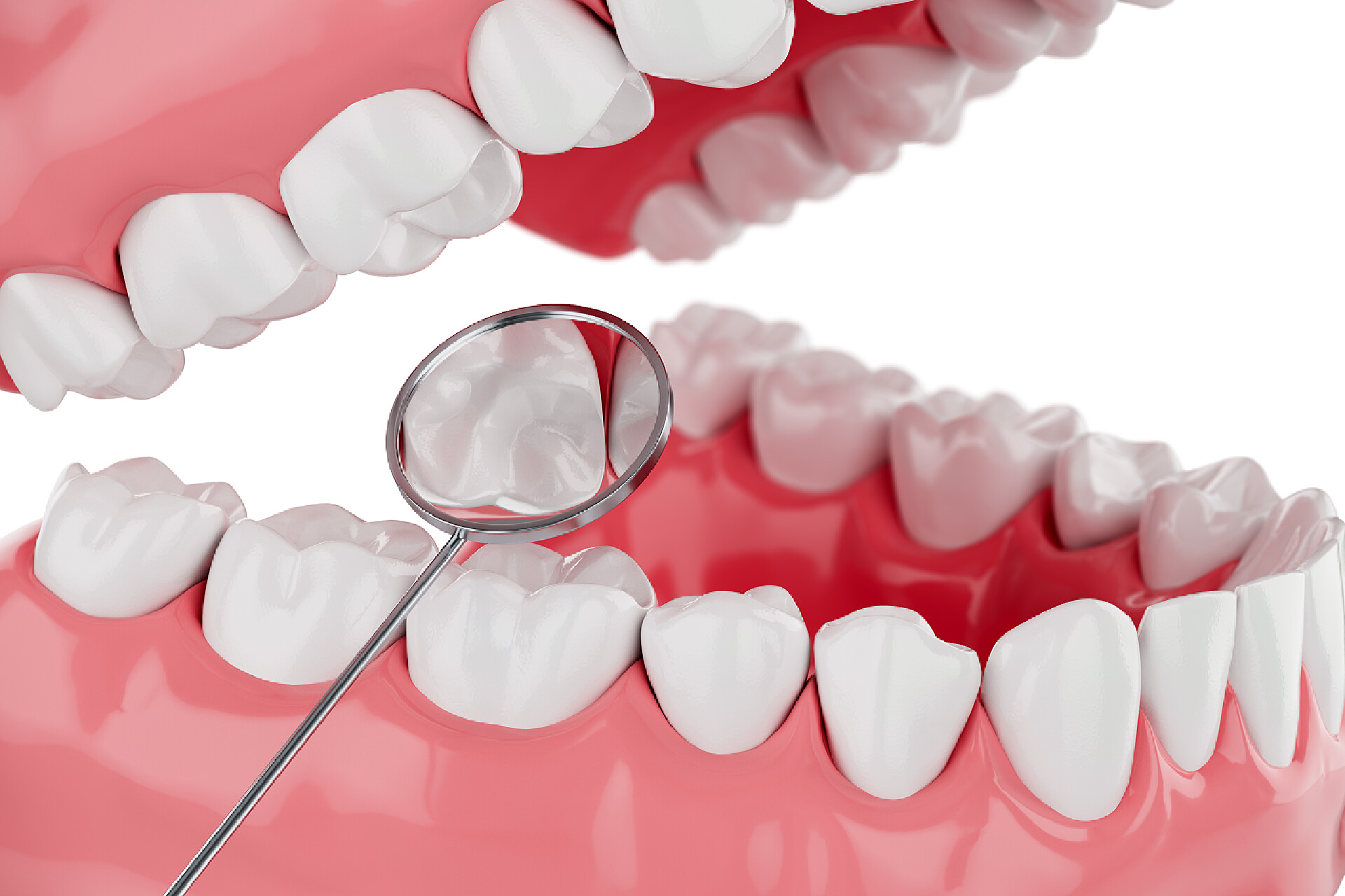 白色背景上的牙齿中有一个放大的牙长偏了在白种人的背景下密切关注美牙保健。有选择的重点。3D渲染.