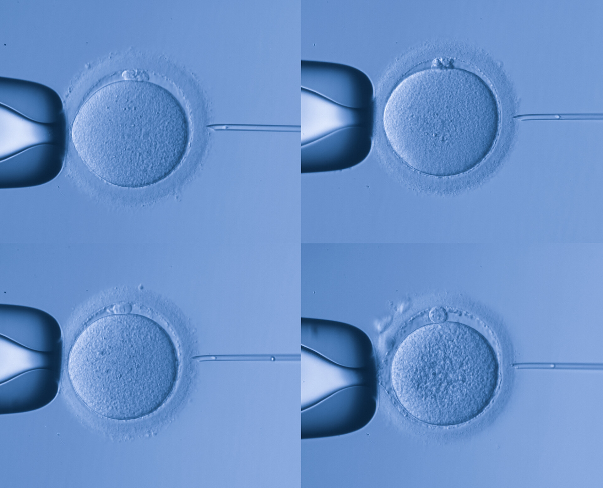 人工授精显微图医疗健康