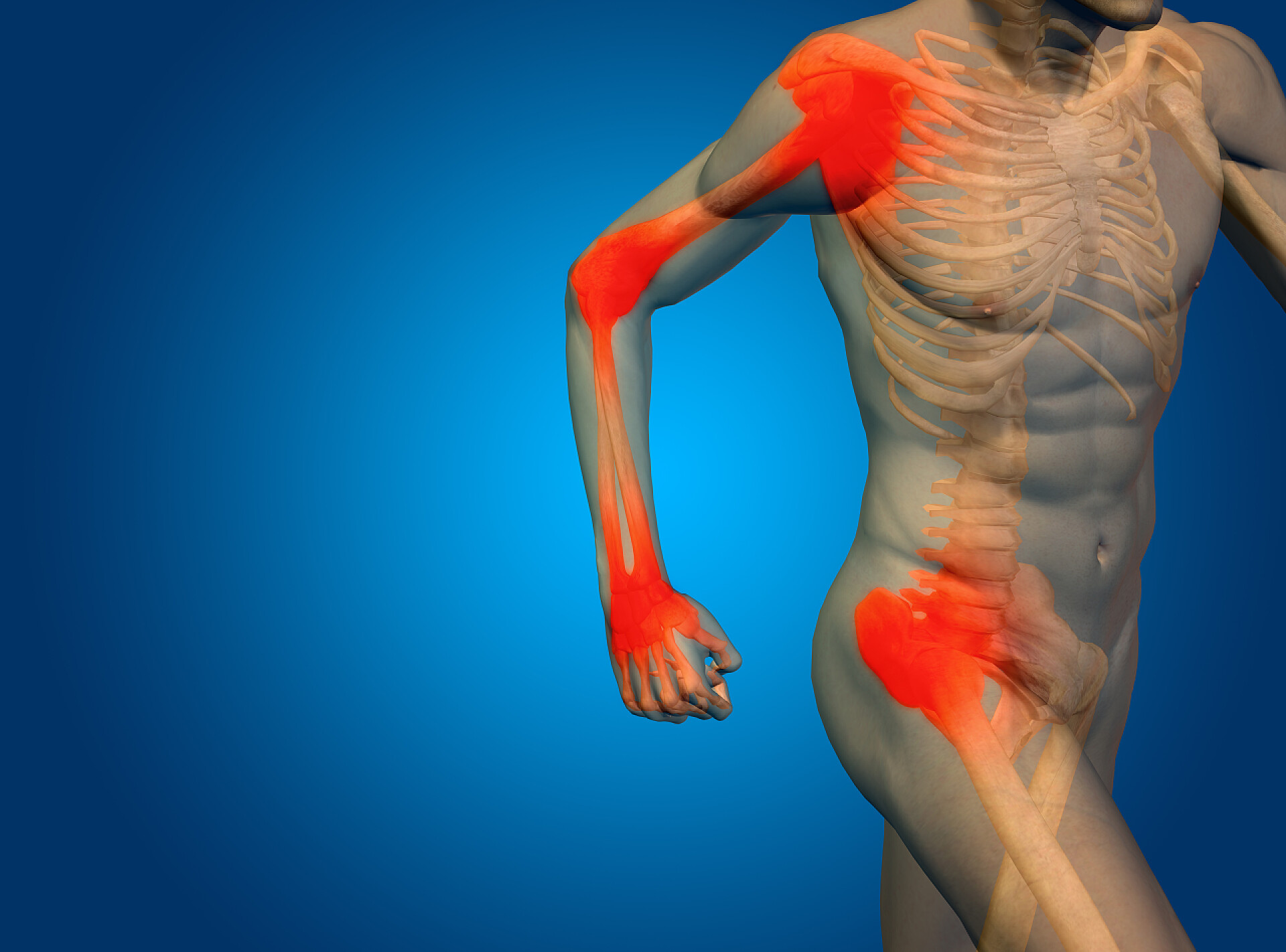 关节痛的人体模型医疗健康