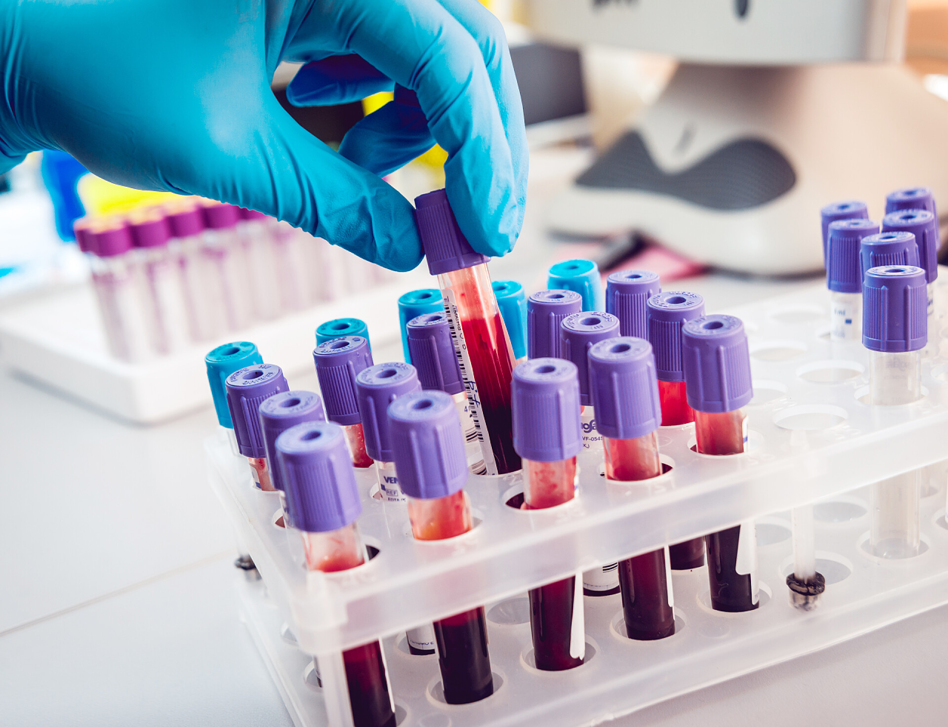 医药科研医疗把血液检测试剂放入试剂盒