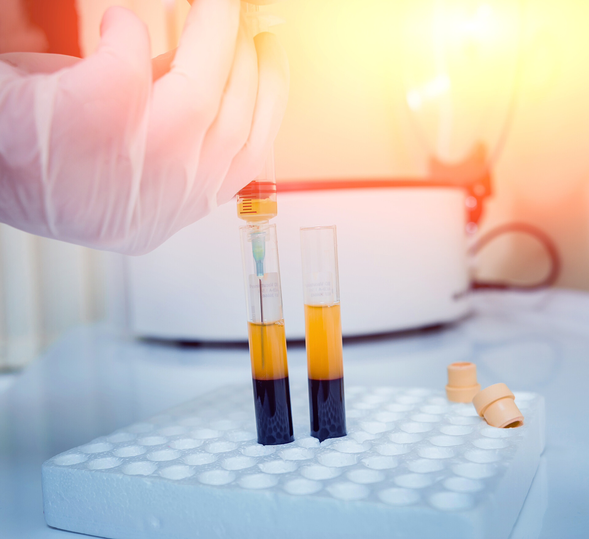 医药科研医疗把注射器中的血浆注射到试管