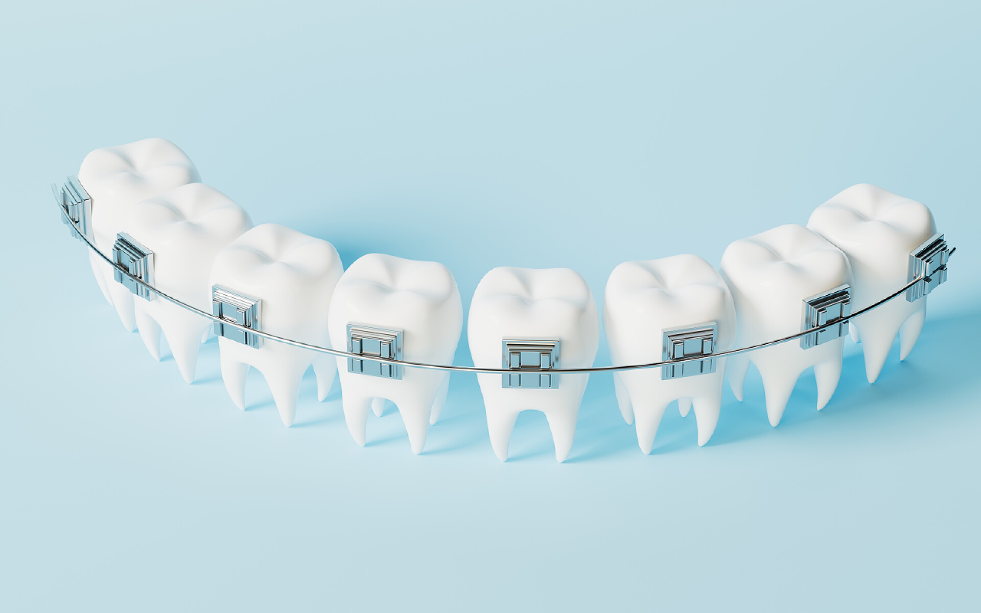 蓝色背景中的假牙牙套