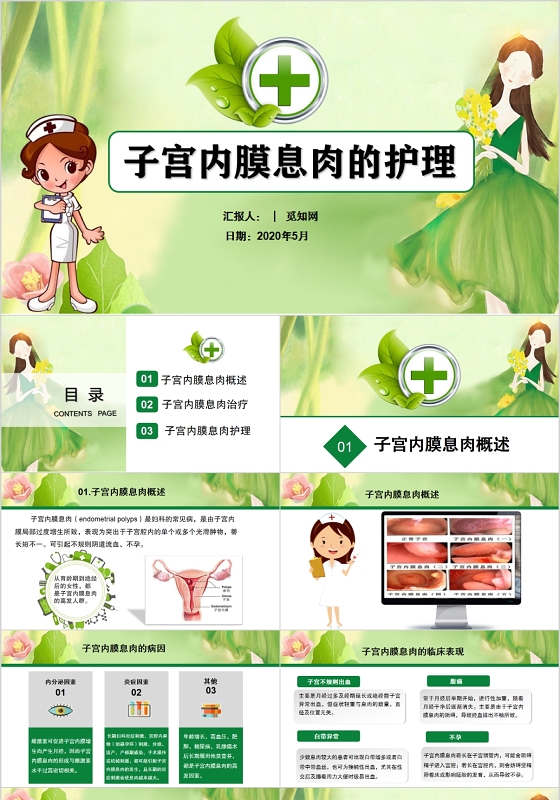 医院医疗子宫内膜息肉护理PPT动态模板