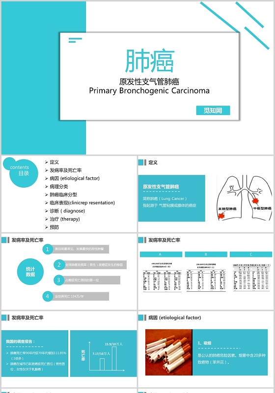 淡蓝色清新简约肺癌护理查房原发性支气管肺癌主题PPT模板