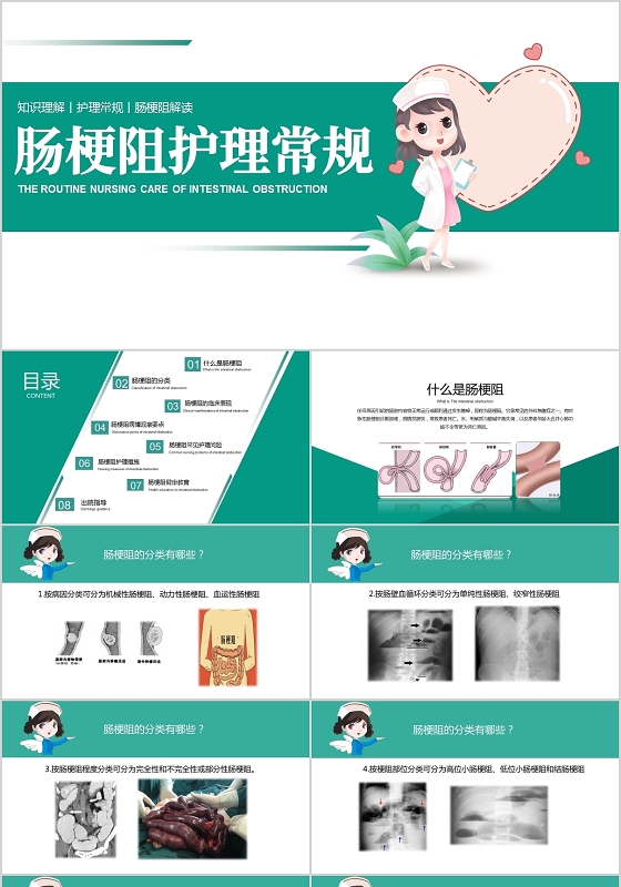 绿色清新肠梗阻护理常规护理查房培训PPT模板