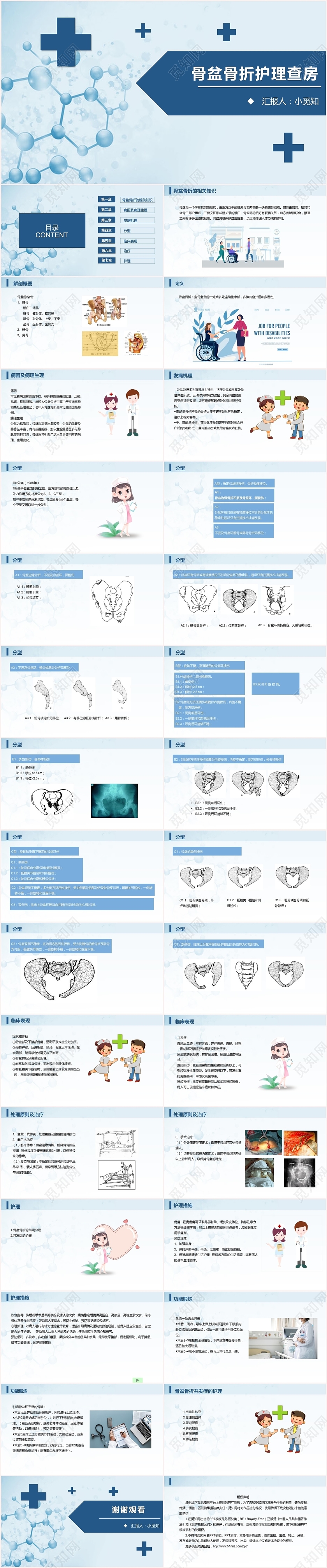 蓝色扁平多发骨盆骨折护理查房PPT模板