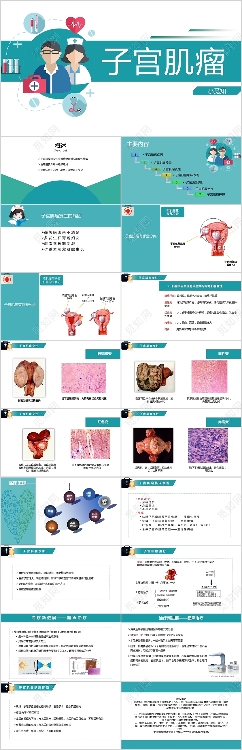 绿色 护理查房  医疗 子宫肌瘤 PPT模板子宫肌瘤护理查房