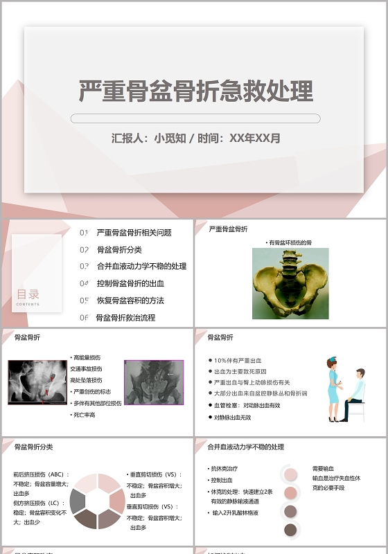 粉色几何风严重骨盆骨折急救处理多发骨盆骨折护理查房PPT模板