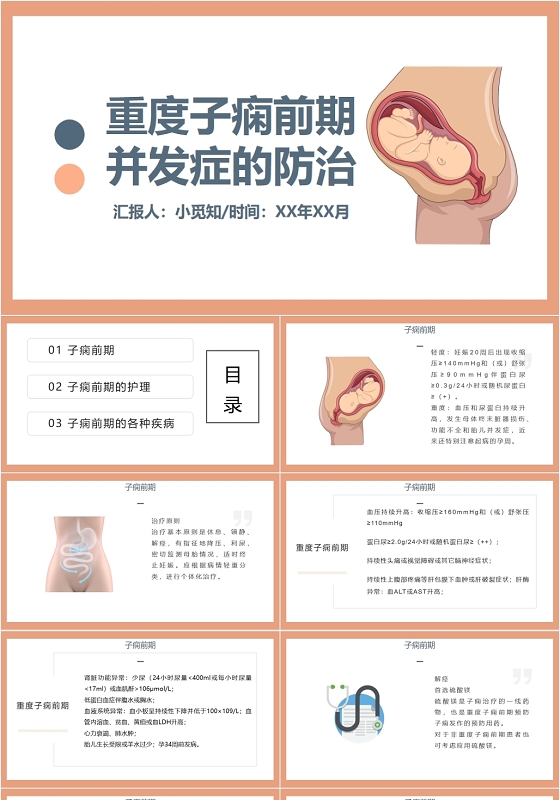 蓝粉色简约风重度子痫前期并发症的防治护理查房ppt模板